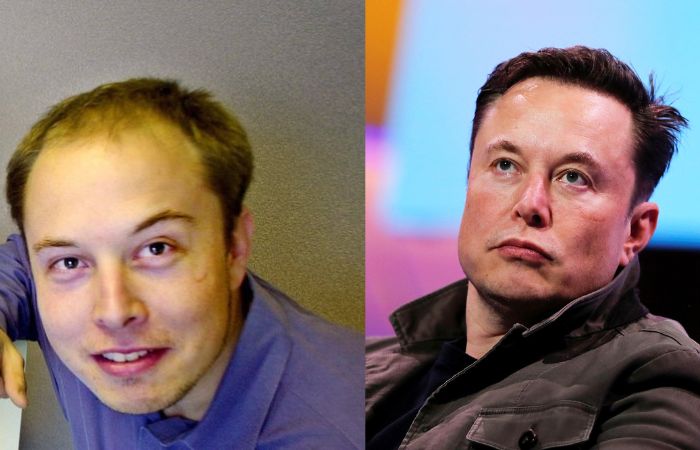 elon_musk_hairfall.jpg